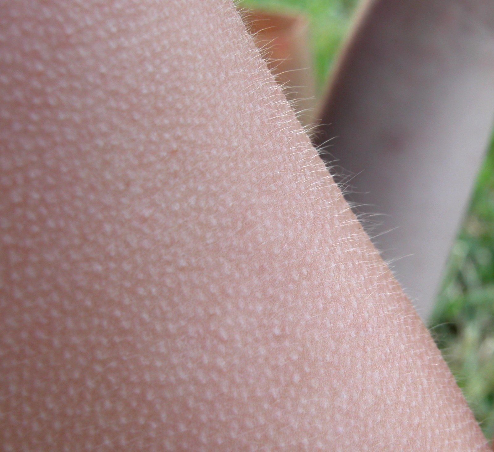 A close-up of goosebumps on a forearm, the fine hairs standing upright